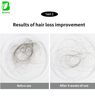 Minoxidil Solution 2% 5% Hair Growth Treatment Liquid （Customizable）