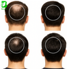 5% Anti‑Hair Loss Liquid External Use Hair Regrowth Scalp Care Solution（Customizable）